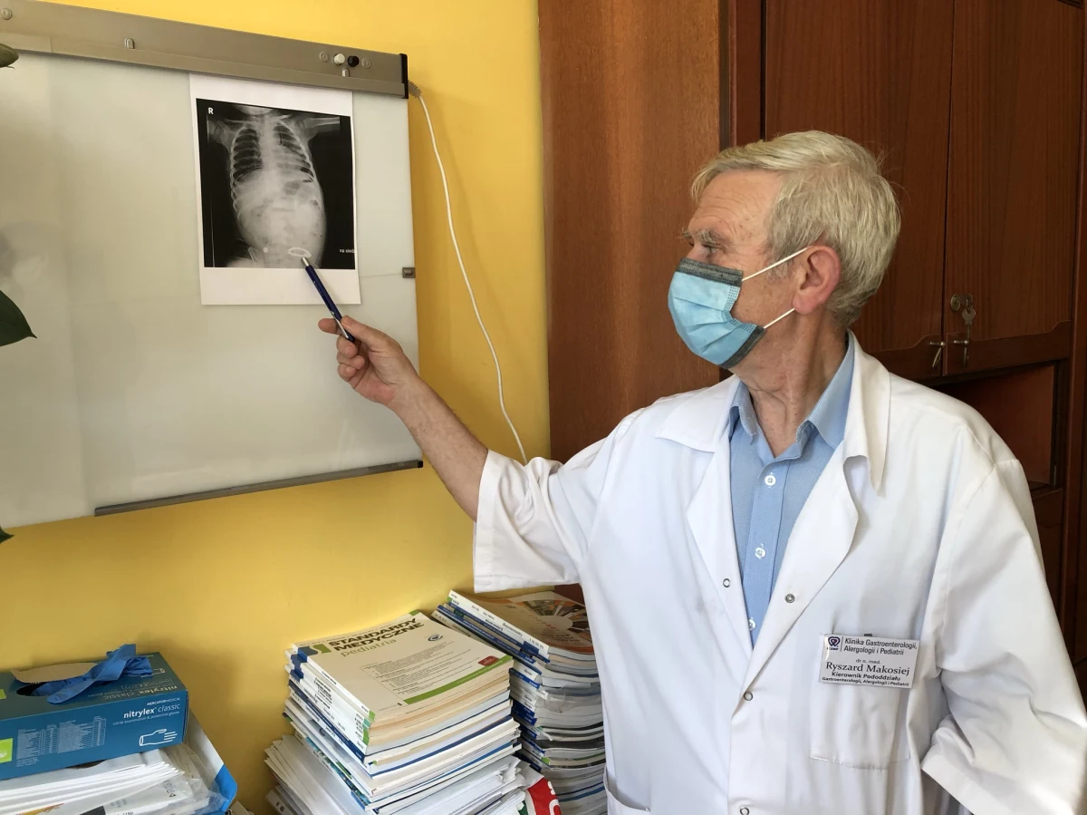 ​Tylko w ubiegłym tygodniu do szpitala Instytutu Centrum Zdrowia Matki w Łodzi trafiło troje dzieci, które połknęły kulki-magnesy. Lekarze alarmują: to jest prawdziwa plaga i bardzo niebezpieczne zjawisko. Rekordzista połknął prawie 20 takich niebezpiecznych zabawek-magnesów.