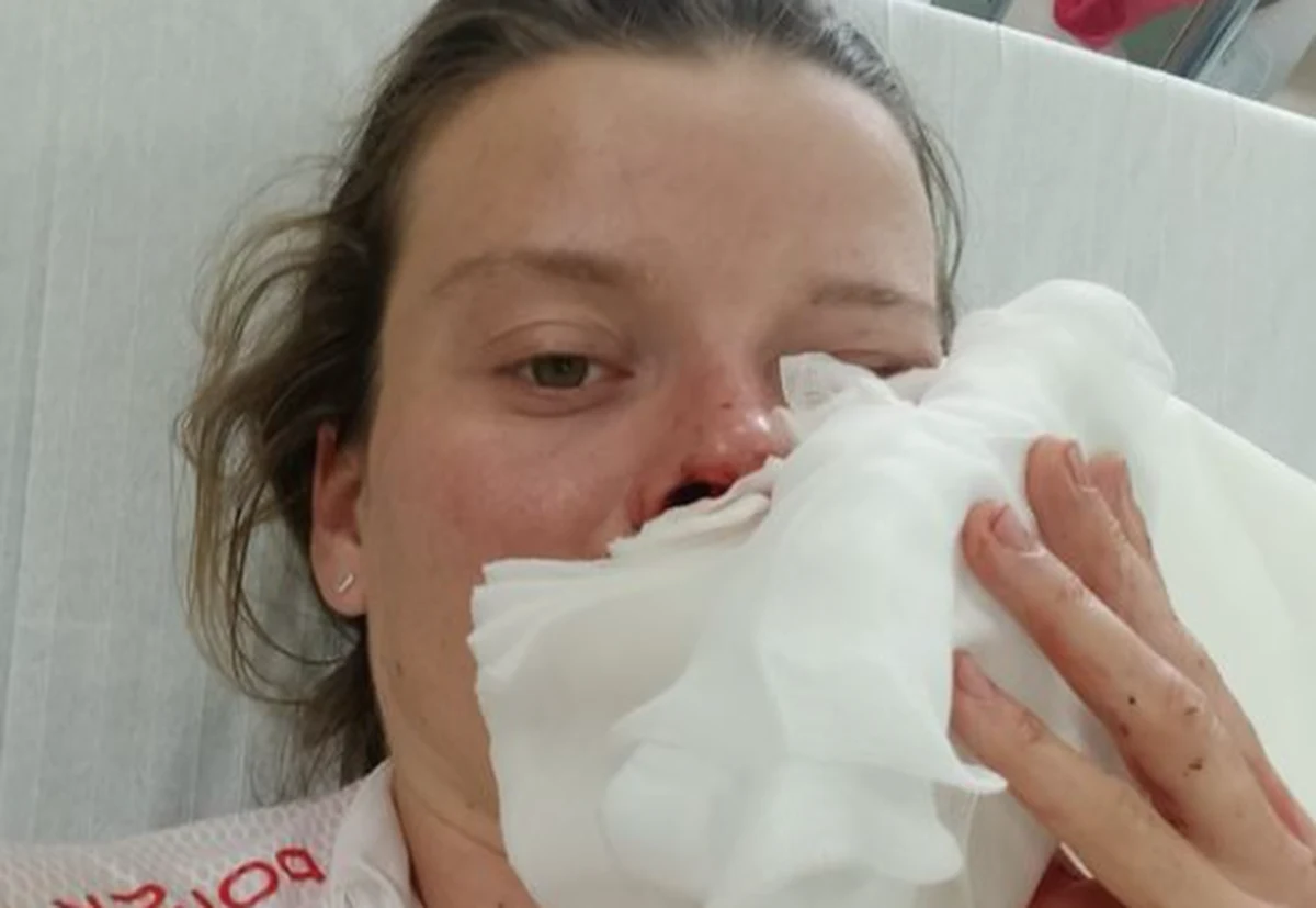 Marta Lach, olimpijka z Tokio w kolarstwie szosowym, została ranna w wypadku, do którego doszło w Andrychowie. Sportsmenka przeszła operację w szpitalu w Wadowicach. W mediach społecznościowych poinformowała, że jest "popuchnięta, ale cała".