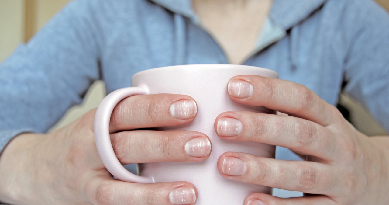 Stan skóry może wskazywać na obniżoną odporność: na jakie znaki zwracać uwagę?