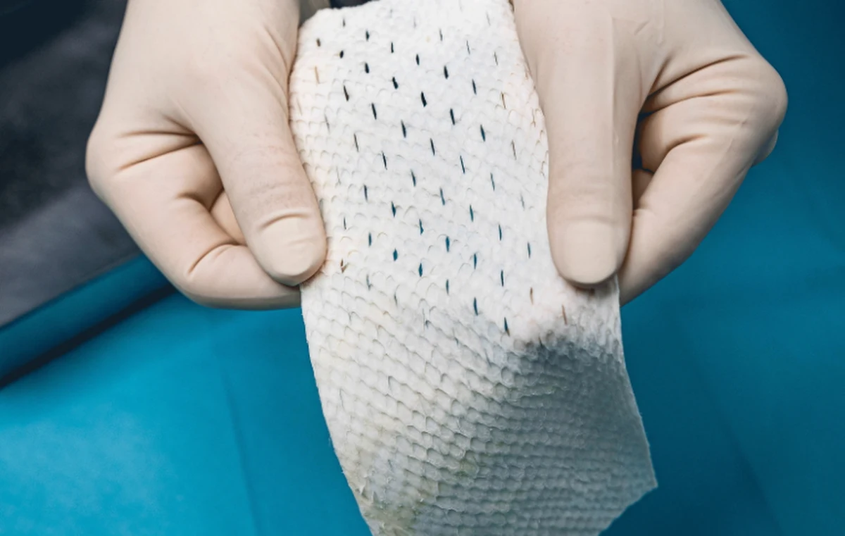 Skóra islandzkich dorszy została dopuszczona przez Amerykańską Agencję ds. Żywności i Leków do stosowania w chirurgii plastycznej i rekonstrukcyjnej, a także do leczenia przewlekłych ran.