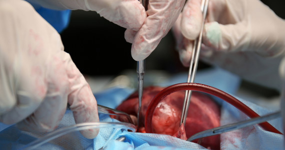 26 października obchodzony jest Światowy Dzień Donacji i Transplantacji. W Polsce pandemia nie wstrzymała wykonywanych przeszczepów.  Jak wynika z najnowszych danych, liczba wykonywanych zabiegów wzrosła.