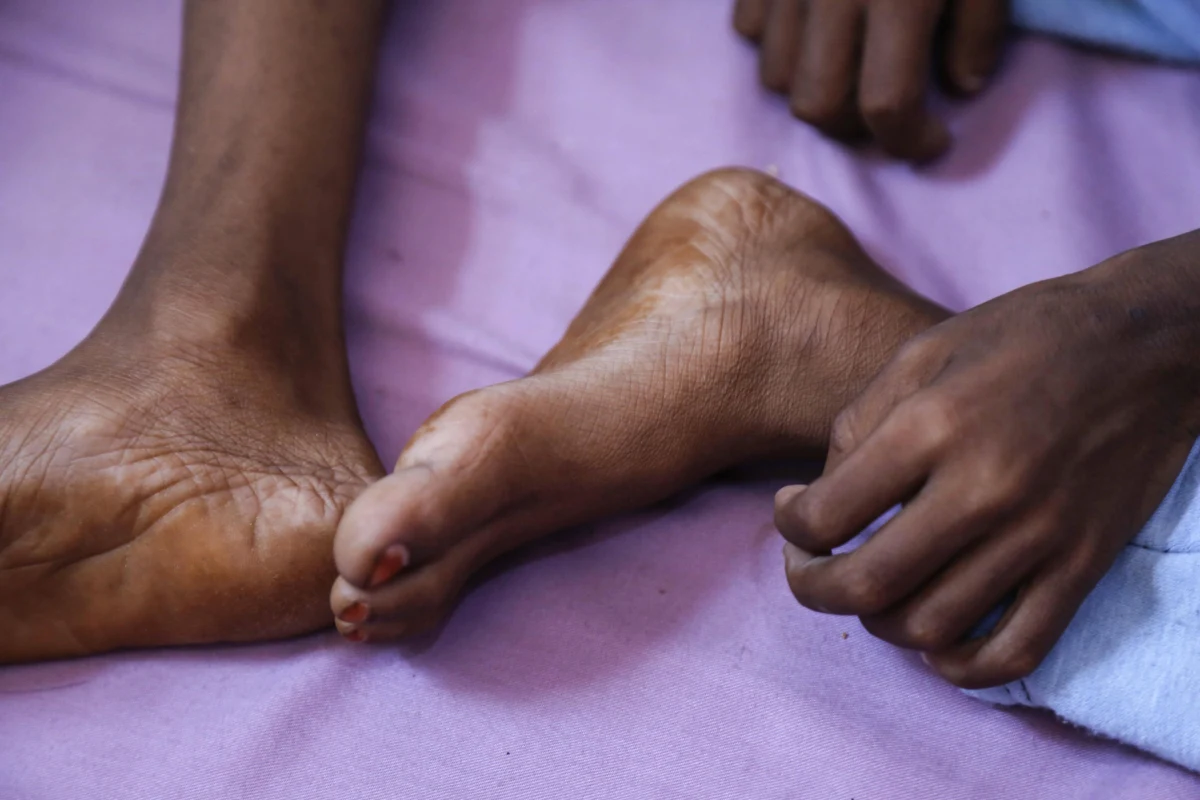 Ponad 45 mln mieszkańcom 43 państw grozi głód. Według danych agencji ONZ Światowego Programu Żywnościowego (WFP), liczba osób, które znalazły się na skraju głodu - drastycznie wzrasta. Jest ich o 3 mln więcej niż w roku 2020.