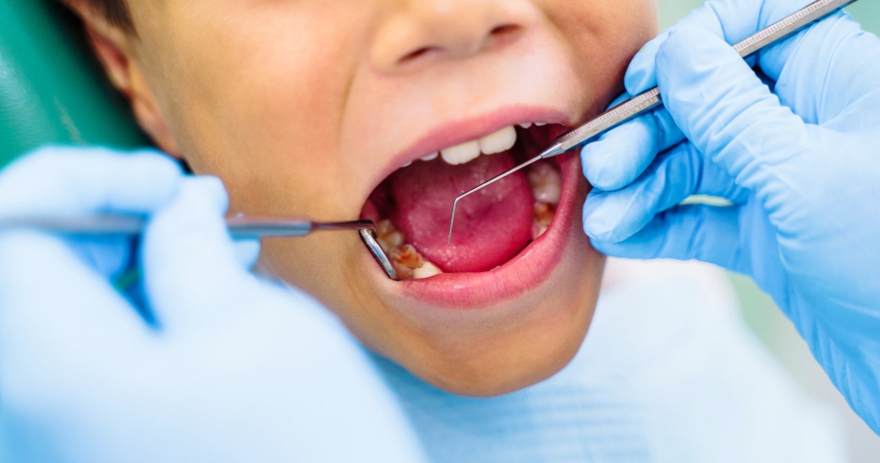 Koniec z borowaniem? Opracowali żel, który naprawia zęby