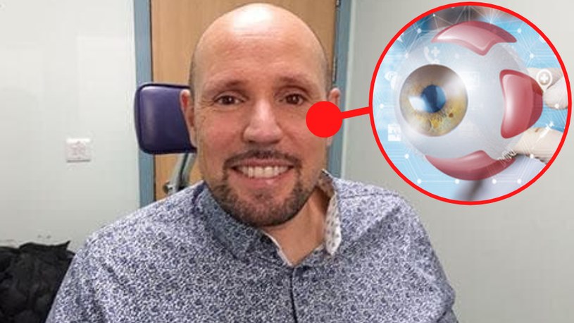 Jak poinformował szpital Moorfields Eye Hospital w Londynie, jego podwoje opuścił właśnie pierwszy pacjent na świecie wyposażony w protezę oka, która została przygotowana za pomocą cyfrowego druku 3D. 
