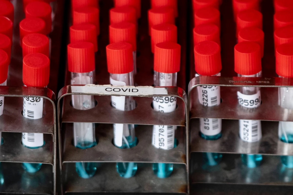 W szpitalu pediatrycznym Bambino Gesu w Rzymie po raz pierwszy sfotografowano nowy wariant koronawirusa. Omikron został odkryty w RPA, zdiagnozowano go już m.in. w Izraelu, a także w kilku europejskich państwach. 