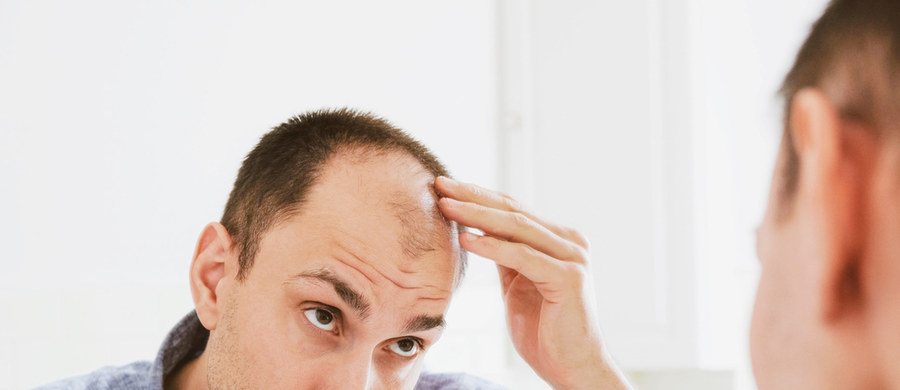 Człowiek ma na głowie przeciętnie 100-150 tys. włosów, a dziennie traci ich ok. 50-100. Jest to proces całkowicie normalny i nie powinien być powodem do niepokoju. Oczywiście, pod wpływem różnych czynników, takich jak wyższy poziom stresu, przemęczenie czy niedobór witamin i minerałów w diecie, włosów może wypadać więcej, a ich faktura zmieniać się na niekorzyść (włosy stają się wyraźnie cieńsze, słabsze czy łamliwe). Może to być jednak sytuacja jedynie okresowa, którą stosunkowo łatwo opanować poprzez wprowadzenie niezbędnych zmian, np. w diecie czy trybie życia.