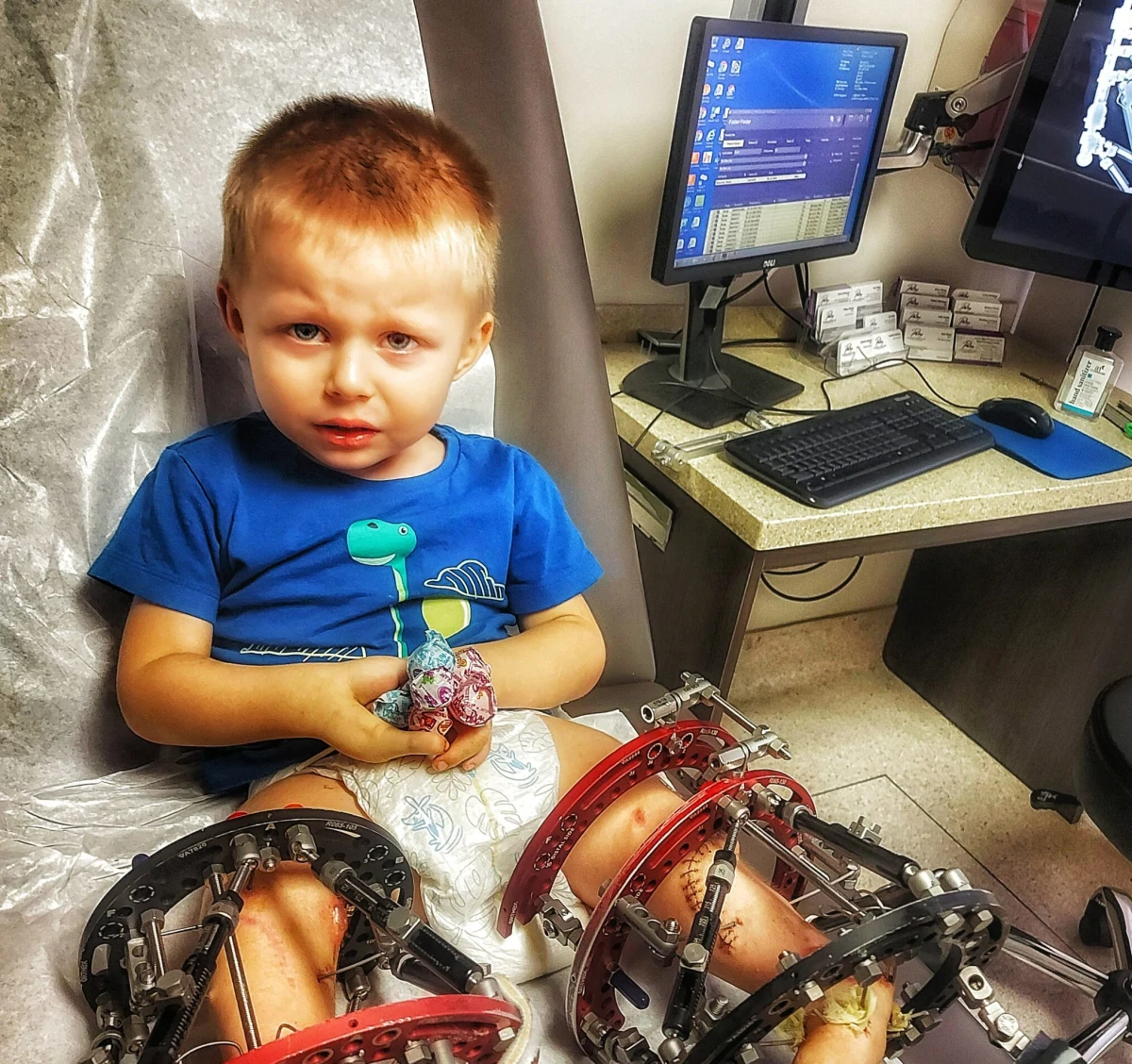 ​Puszka z datkami na rehabilitację ciężko chorego dziecka zniknęła ze sklepu przy ul. Santockiej w Szczecinie. Moment kradzieży uwieczniła kamera monitoringu, a rodzina małego Bruna, który urodził się ze zdeformowanymi nogami, prosi o pomoc w odnalezieniu złodzieja i pieniędzy. 