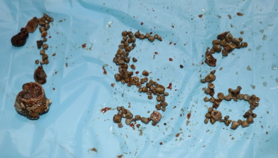 /FOTO: Hyderabad hospital /