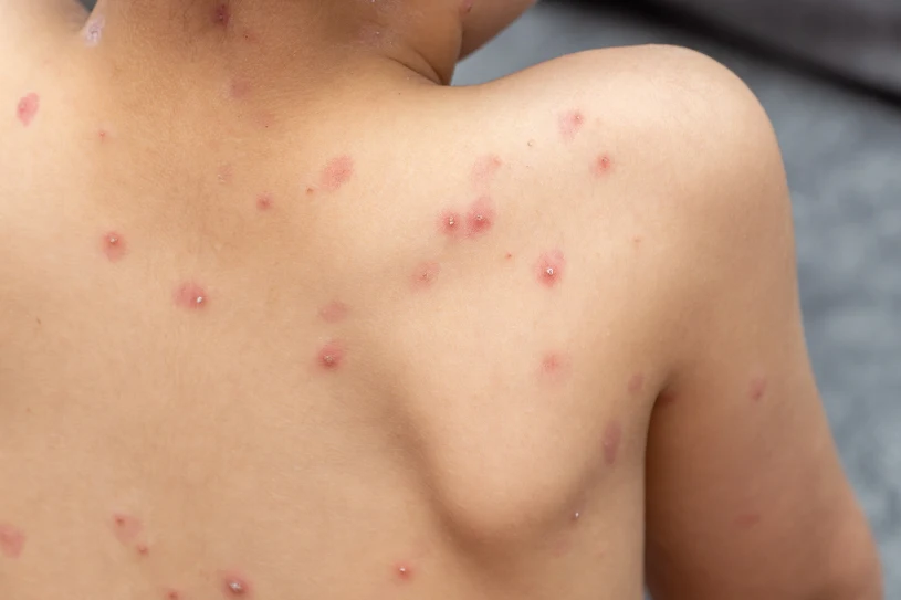 To wina Brytyjczyków. Poznaliśmy przyczynę niszczycielskiej epidemii z 1789