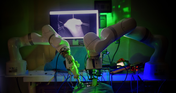 Chirurgiczny robot STAR (Smart Tissue Autonomous Robot ) zbudowany przez zespół z Johns Hopkins University wykonał pierwsze laparoskopowe zabiegi bez pomocy człowieka - informuje w najnowszym numerze czasopismo "Science Robotics". Zabiegi przeprowadzono na czterech świniach, u których robot całkowicie automatycznie wykonał zespolenie przeciętych jelit. To może być zwiastun prawdziwego przełomu w chirurgii. Tego typu urządzenia mogą przejąć część zadań lekarzy, w przypadku trudnych i wymagających szczególnej precyzji, ale jednak standardowych części zabiegów.