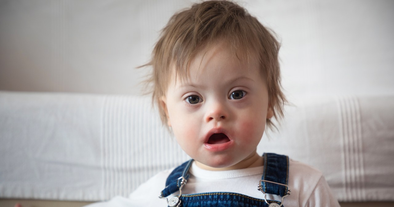 Wady u płodu (trisomie) rodzaje, objawy, badania Zdrowie