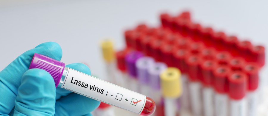 Wirus Lassa dotarł do Wielkiej Brytanii. Jest wysoce śmiertelny, bardziej niż SARS-CoV-2. W większości przypadków zakażenie przebiega bezobjawowo. Wywołuje chorobę zwaną gorączką krwotoczną Lassa. Jak można się zarazić?