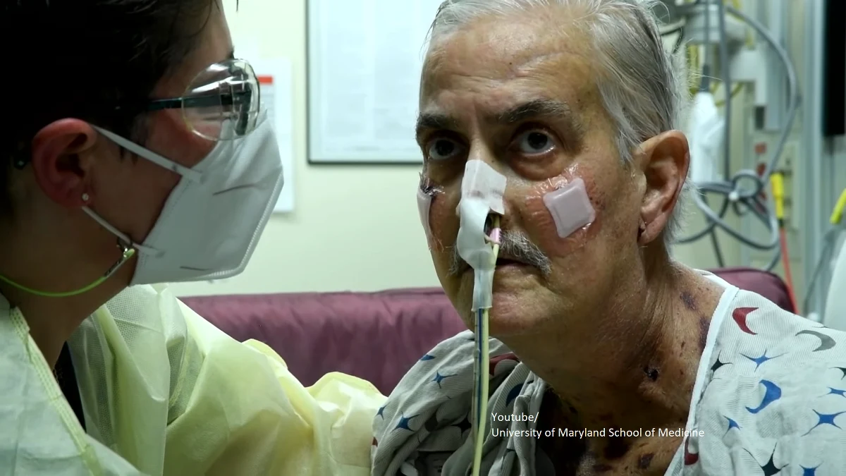 W szpitalu w Baltimore w stanie Maryland w USA zmarł w środę David Bennett, jedyny jak do tej pory człowiek na świecie, któremu wszczepiono serce świni - poinformowały miejscowe służby medyczne. Eksperymentalny przeszczep został wykonany dwa miesiące temu.