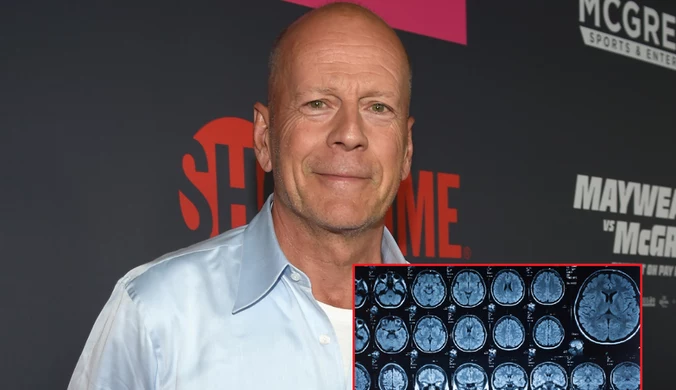 Co to jest afazja? To z jej powodu Bruce Willis kończy karierę