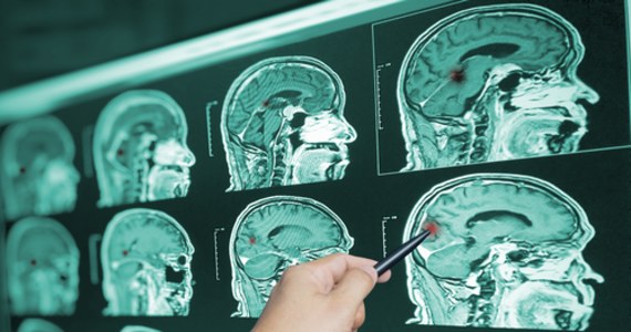 Naukowcy z Uniwersytetu Gdańskiego chcą sprawdzić jak koronawirus wpływa na starzenie się naszego mózgu. Poszukiwane są osoby chętne  do badań.
