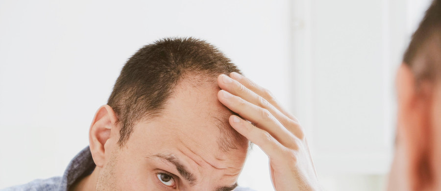 Wypadające włosy mogą spędzać sen z powiek. Problem może wydawać się mało istotny, jednak może być oznaką rozpoczynających się groźnych chorób. Wyróżnia się trzy rodzaje wypadania włosów: telogenowe, androgenowe, plackowate (w tym złośliwe).