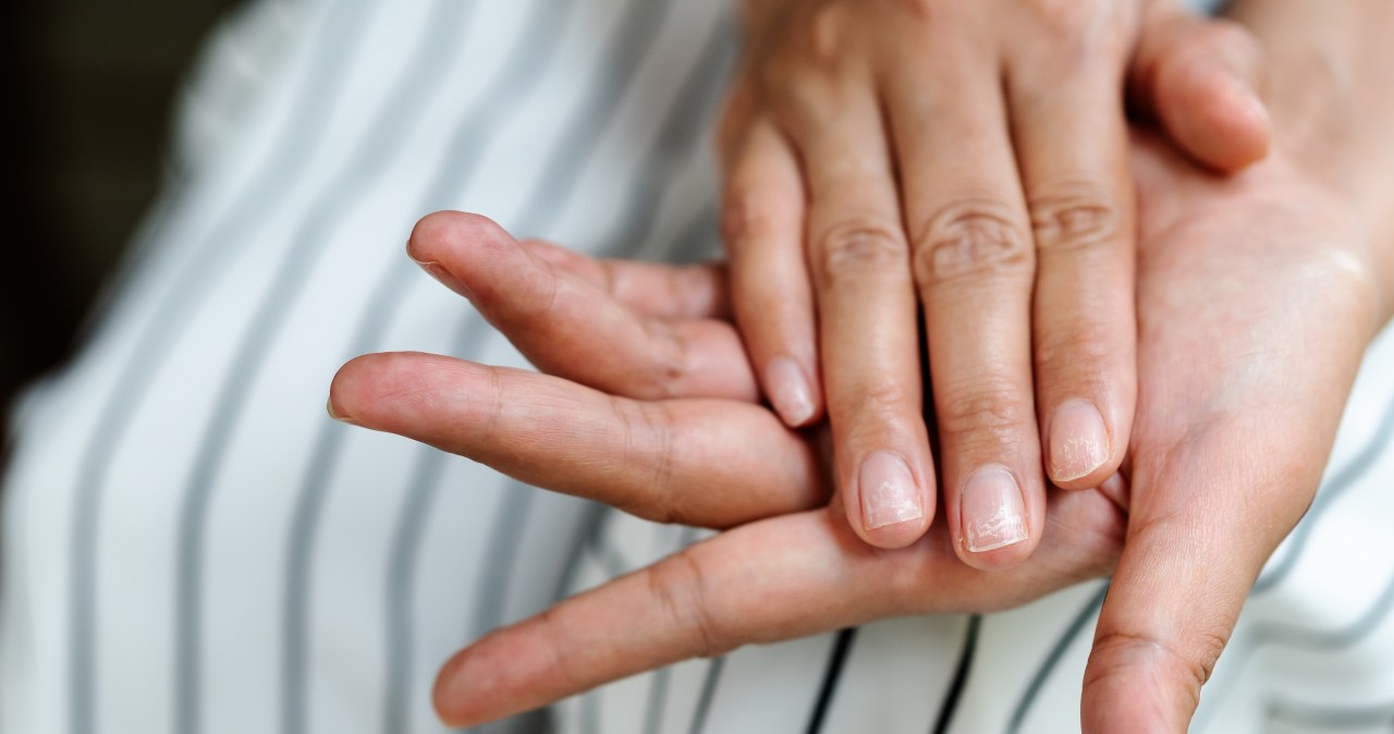 Mało kto łączy to z paznokciami. A to częsty sygnał niedoborów i zaburzeń