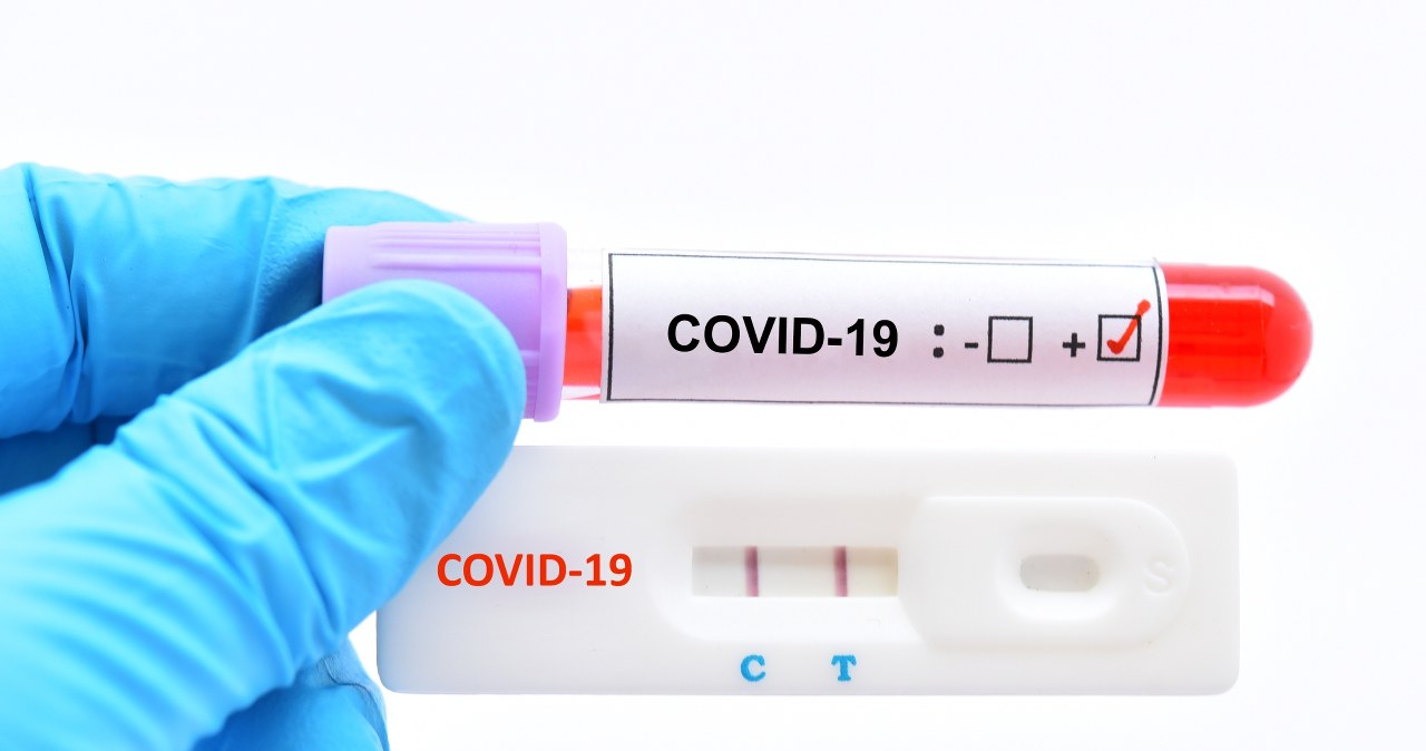 Zgony przez COVID-19. Rzeczywista liczba ofiar była znacznie wyższa