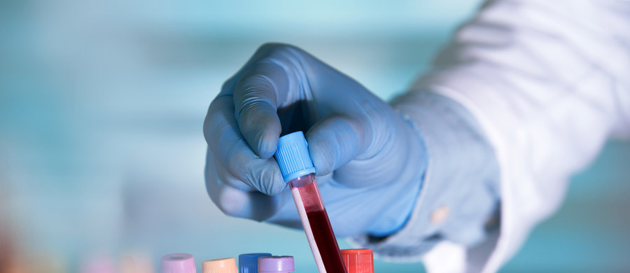 Zmiany przednowotworowe, anemia czy inne schorzenia pomoże wykryć test na krew utajoną w kale. Osobom, które skończyły 50 lat zaleca się wykonanie tego badania raz - dwa razy do roku.  