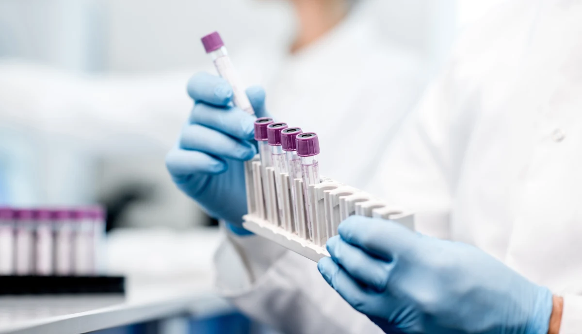 W Republice Czeskiej potwierdzono pierwszy przypadek małpiej ospy - poinformował portal Seznam Zpravy. Ekspert powiedział portalowi, że pojawienie się wirusa potwierdził Państwowy Instytut Zdrowia (SZU). 