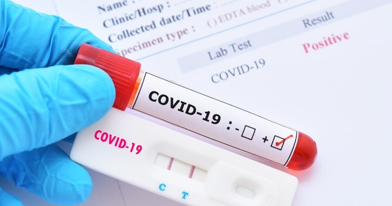 Minionej doby badania potwierdziły 262 zakażenia koronawirusem, w tym 25 ponownych. Zmarło 6 osób z Covid-19 – poinformowano na stronach rządowych. Wykonano 7746 testów w kierunku SARS-CoV-2.