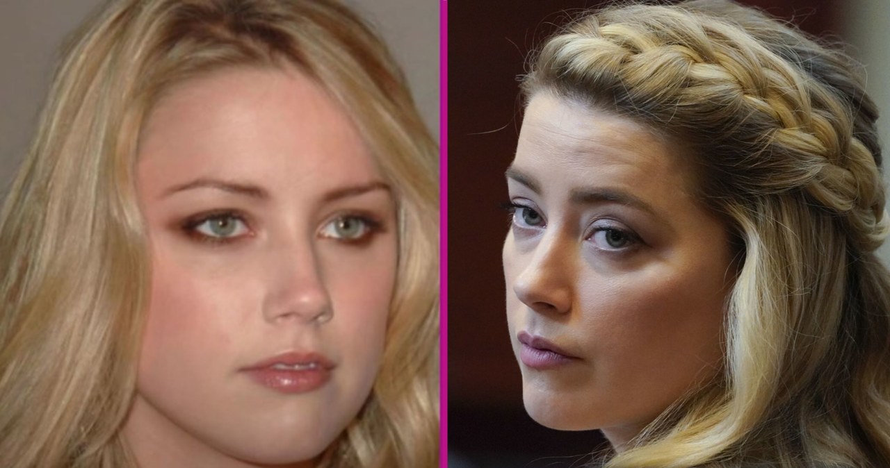 Amber Heard z całkowicie odmienioną twarzą. Przeszła operację plastyczną? -  pomponik.pl