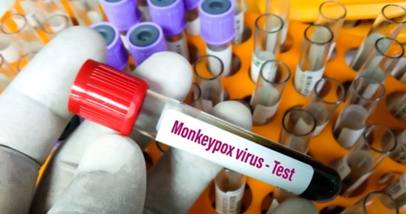 Komisja Europejska zakupiła ze wspólnych unijnych pieniędzy 110 tys. dawek szczepionki przeciw małpiej ospie – dowiedziała dziennikarka RMF FM w Brukseli Katarzyna Szymańska-Borginon. Pierwsze dawki trafią do krajów członkowskich Unii pod koniec tego miesiąca.