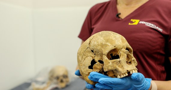 Sześć czaszek ze średniowiecznego cmentarza odkrytego przed kilkoma laty w Gliwicach zostanie przebadanych przez współczesnych dentystów w Katowicach z wykorzystaniem nowoczesnego sprzętu i technologii 3D.
