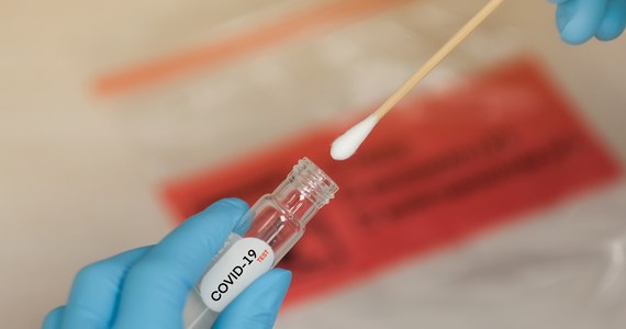 Minionej doby badania potwierdziły 234 zakażenia koronawirusem, w tym 25 ponownych. Zmarło 7 osób z Covid-19 - poinformowano w środę na stronach rządowych. Wykonano 4315 testów w kierunku SARS-CoV-2.
