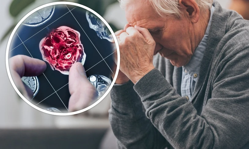 Przełom w leczeniu Alzheimera. Odkryli sposób na cofnięcie choroby