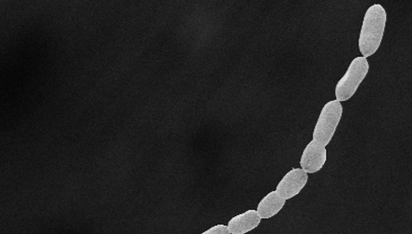 Thiomargarita magnifica.  Oamenii de știință descoperă „Muntele Everest” printre bacterii