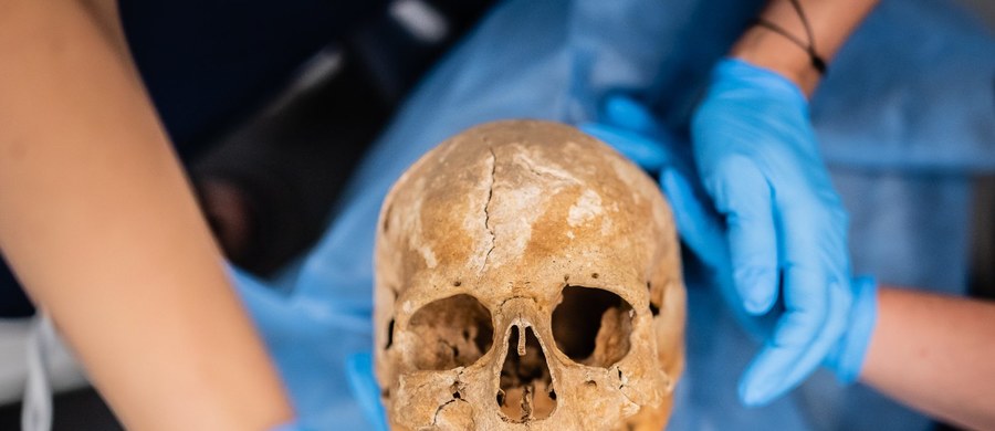 Do katowickich dentystów trafiły czaszki pochodzące z późnośredniowiecznego cmentarza odkrytego w Gliwicach. Przeszły pełną ścieżkę diagnostyczną: od przeglądu po cyfrowe skany 3D. Wnioski? Próchnica i jej powikłania nie dokuczały im w takiej skali, jak nam teraz. 