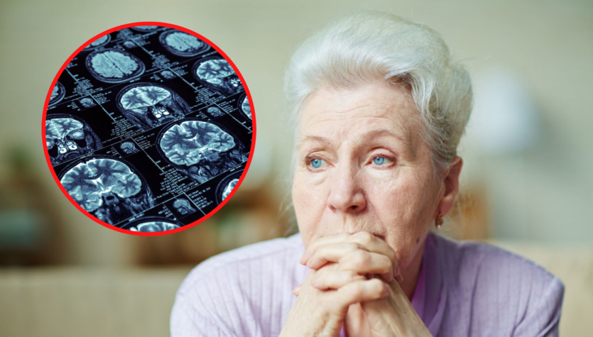 Causas de la enfermedad de Alzheimer: dieta, ejercicio y actividad cerebral