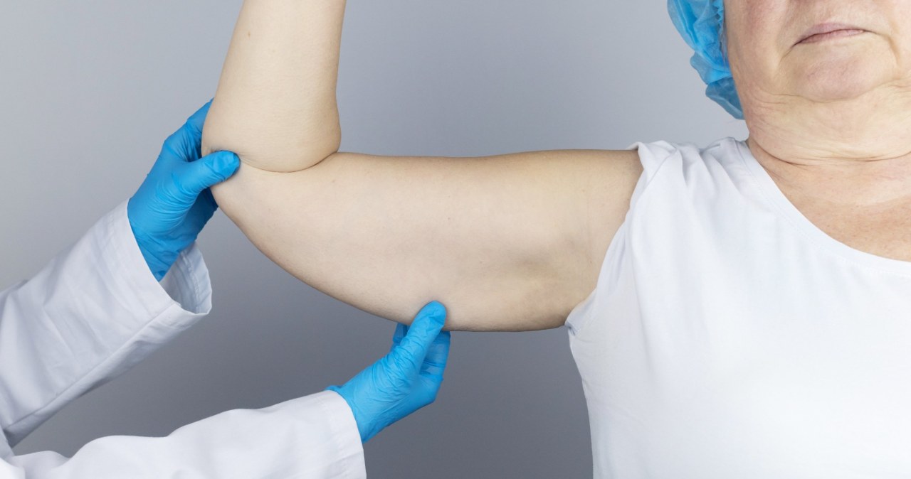 Zapomnij o wiotkiej skórze na ramionach. Ta metoda jest zabójcza dla "pelikanów"