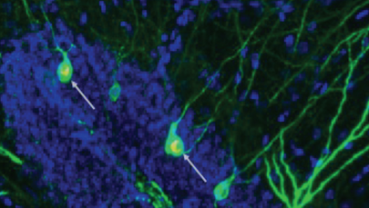 Nowe neurony do walki z Alzheimerem