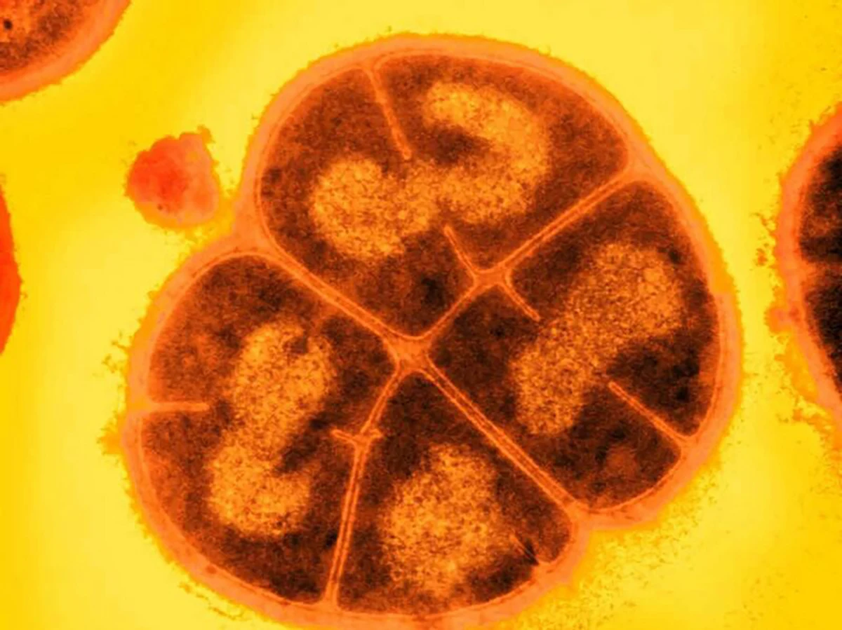 Jeśli na Marsie istniało kiedyś życie, szanse jego przetrwania mogły być większe, niż nam się do tej pory wydawało. Nie można byłoby wykluczyć, że jeszcze tam się kryje. Ogłoszone na łamach czasopisma "Astrobiology" wyniki badań wskazują na to, że pod powierzchnią Czerwonej Planety życie mogłoby przetrwać w uśpieniu nawet przez setki milionów lat. Badacze ze Stanów Zjednoczonych i Słowenii pokazali to na przykładzie wyjątkowo odpornej na temperaturę, toksyny i promieniowanie kosmiczne bakterii z gatunku Deinococcus radiodurans. W nawiązaniu do Conana Barbarzyńcy czasem nazywa się ją nawet Conanem Bakterią.