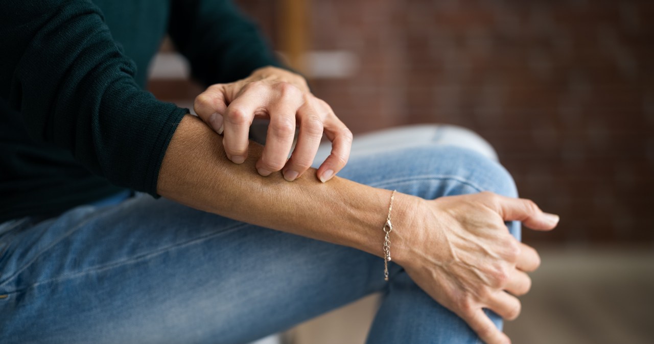 Tak daje o sobie znać stres. Nietypowy objaw zauważysz na skórze