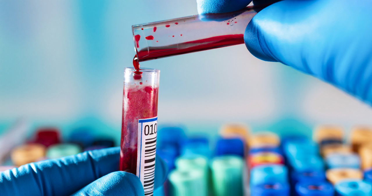 National Health Service, czyli brytyjska agencja rządowa zajmująca się zdrowiem, poinformowało o bardzo obiecujących wynikach badań innowacyjnego testu krwi wykrywającego 50 typów raka.