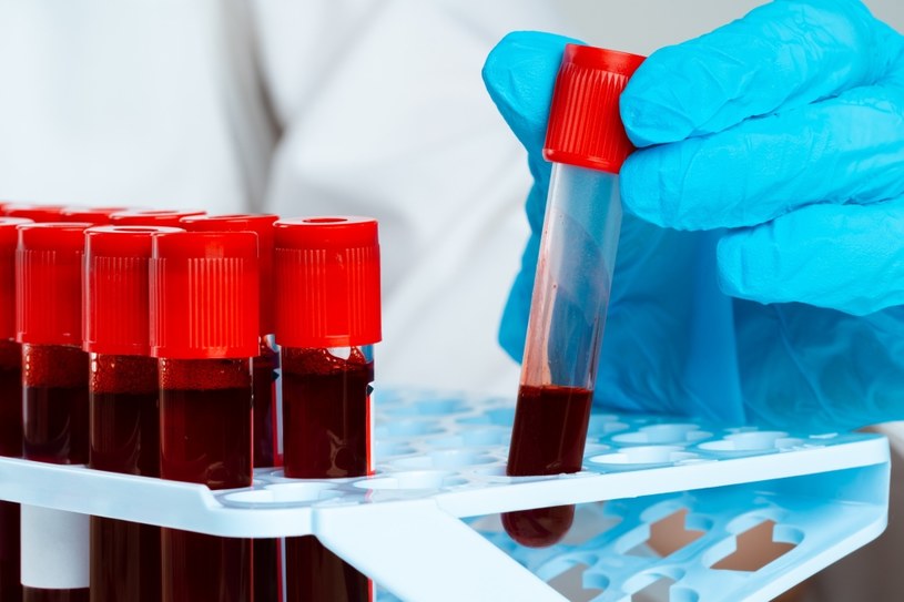 Amerykańska Agencja Żywności i Leków (FDA) dopuściła właśnie do obrotu nową metodę leczenia rzadkiej choroby krzepnięcia krwi, a mianowicie lek o nazwie Hemgenix, który pomoże pacjentom cierpiącym z powodu hemofilii B.