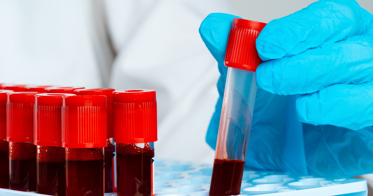 Amerykańska Agencja Żywności i Leków (FDA) dopuściła właśnie do obrotu nową metodę leczenia rzadkiej choroby krzepnięcia krwi, a mianowicie lek o nazwie Hemgenix, który pomoże pacjentom cierpiącym z powodu hemofilii B.