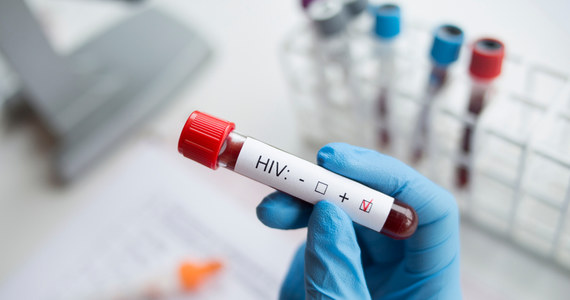 ​763 anonimowe i bezpłatne testy w kierunku HIV wykonał w tym roku punkt konsultacyjno-diagnostyczny działający przy Szpitalu Wojewódzkim w Szczecinie. 18 razy wynik okazał się pozytywny. Wszystkie osoby z dodatnim wynikiem zostały objęte opieką w przyszpitalnej poradni nabytych niedoborów immunologicznych. 1 grudnia przypada Światowy Dzień Walki z AIDS.