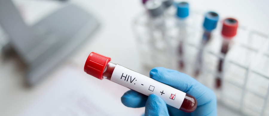 ​763 anonimowe i bezpłatne testy w kierunku HIV wykonał w tym roku punkt konsultacyjno-diagnostyczny działający przy Szpitalu Wojewódzkim w Szczecinie. 18 razy wynik okazał się pozytywny. Wszystkie osoby z dodatnim wynikiem zostały objęte opieką w przyszpitalnej poradni nabytych niedoborów immunologicznych. 1 grudnia przypada Światowy Dzień Walki z AIDS.