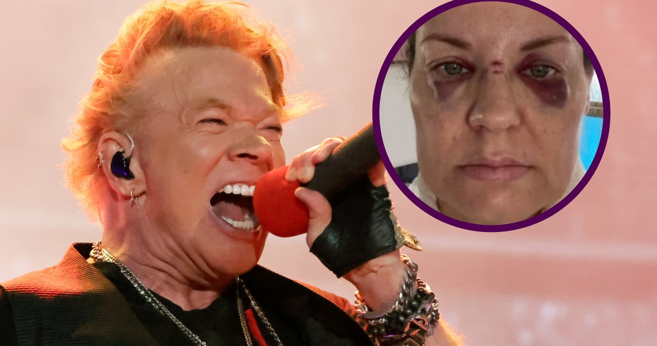 Axel Rose z Guns N Roses rzucił mikrofonem w tłum. Skończyło się tak ...