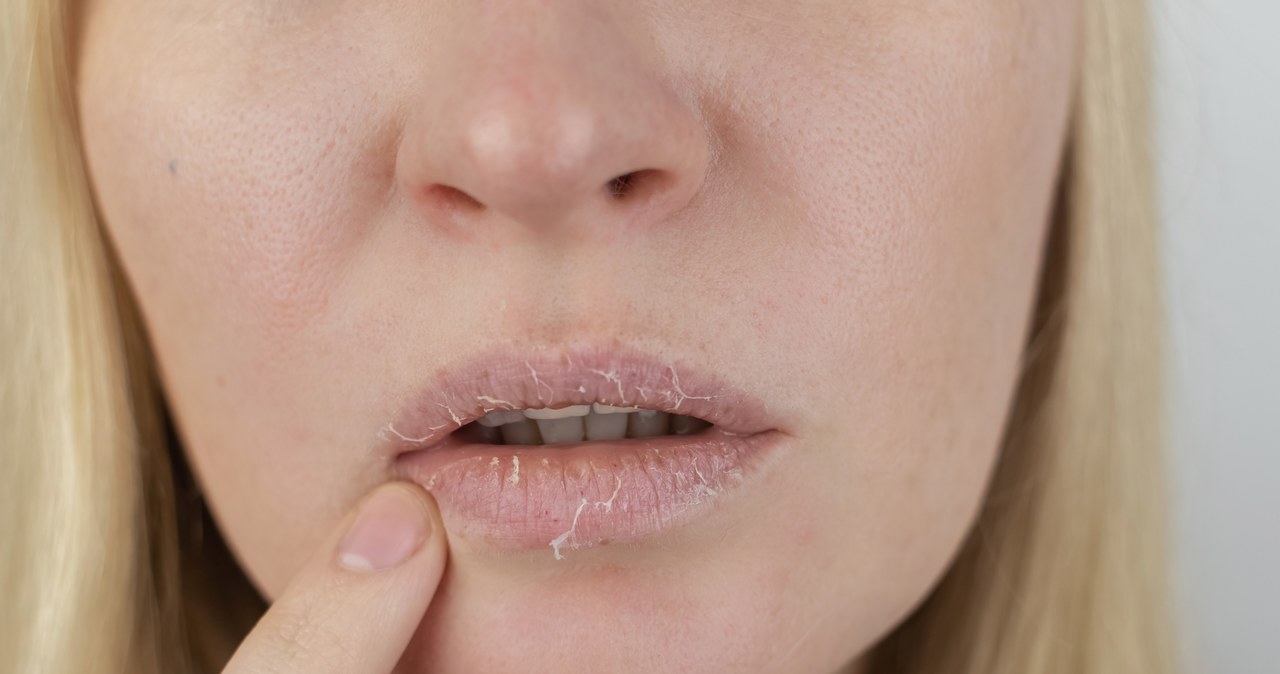 Szminki ochronne nie nawilżają ust? Dermatolożka radzi, czym je zastąpić