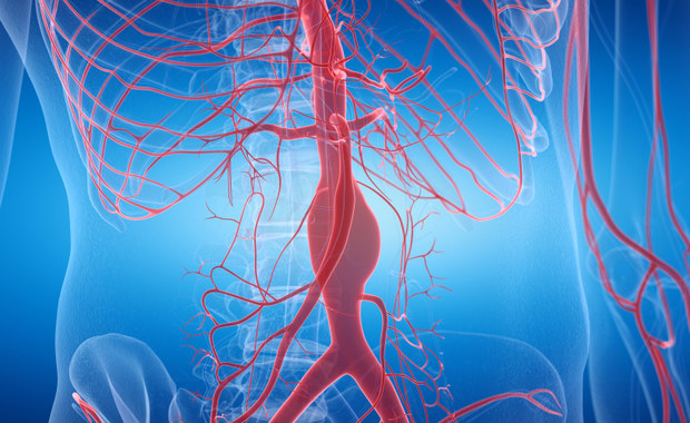 O tętniaku aorty mówimy wtedy, gdy dochodzi do nadmiernego poszerzenia aorty. Jest to bardzo groźne schorzenie. Pęknięcie tętniaka jest bowiem stanem zagrażającym życiu. Jak do tego dochodzi i czy można się przed tym uchronić? Szczegółowo wyjaśnia to, nasz ekspert lek. Jakub Kuciński z Oddziału Klinicznego Choroby Wieńcowej i Niewydolności Serca w krakowskim Szpitalu im. Jana Pawła II. 