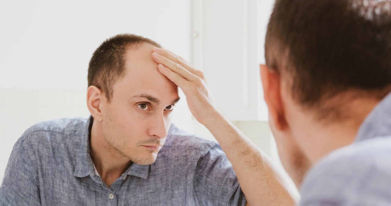 Rewolucyjna terapia na wypadanie włosów. Skuteczność niemal stuprocentowa