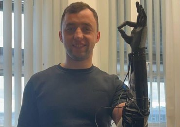 Bioniczne protezy dla ukraińskich żołnierzy, którzy stracili kończyny