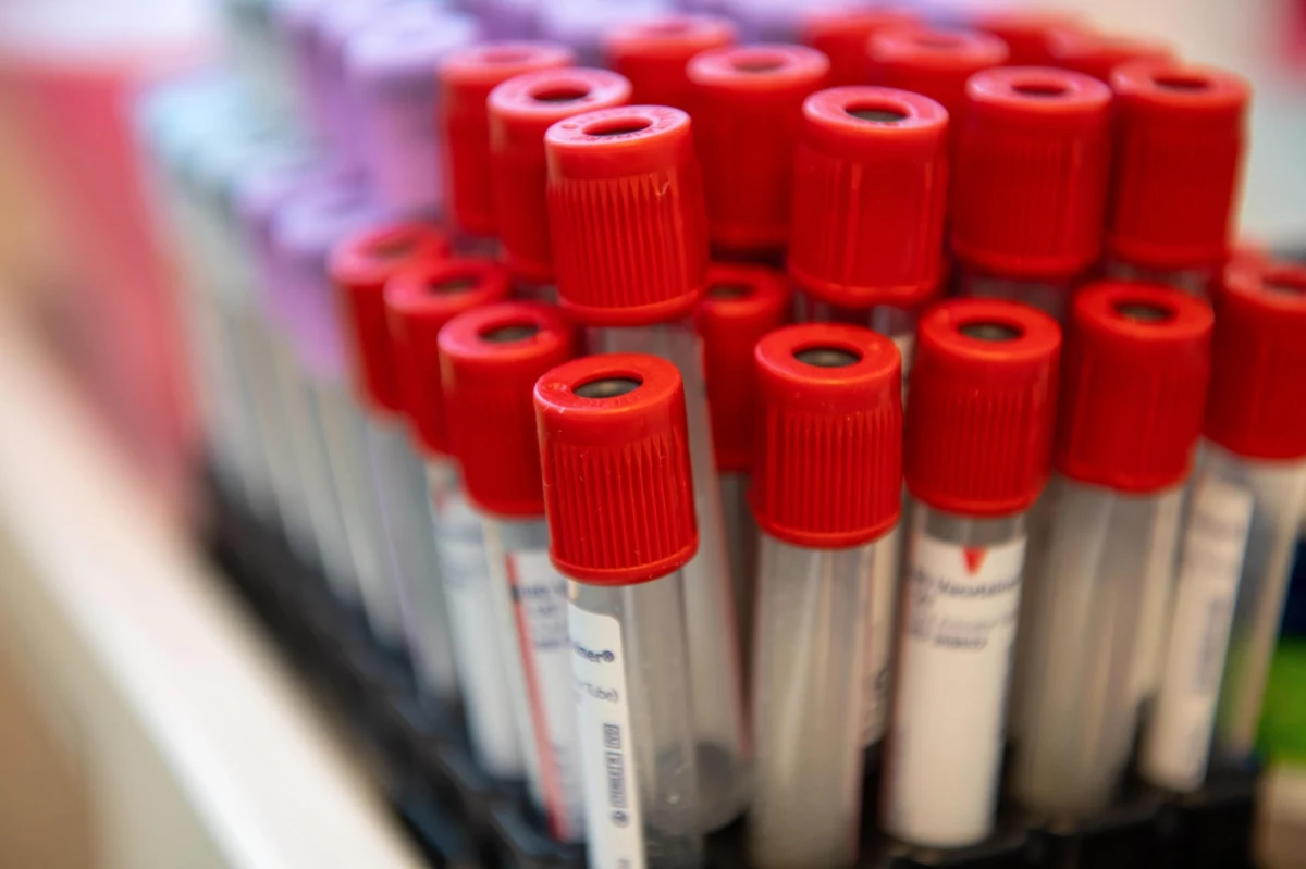 W sobotę w katowickim Szpitalu Specjalistycznym im. Emila Michałowskiego prowadzone będą bezpłatne badania PSA dla mężczyzn. By wziąć w nich udział, nie jest potrzebne skierowanie od lekarza. "PSA o czynnik wskazujący na ryzyko występowania raka prostaty" – wyjaśnia prof. Igal Mor, kierownik medyczny katowickiego szpitala. 