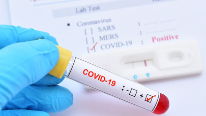  Po Covid-19 ryzyko chorób autoimmunologicznych jest 3 razy wyższe