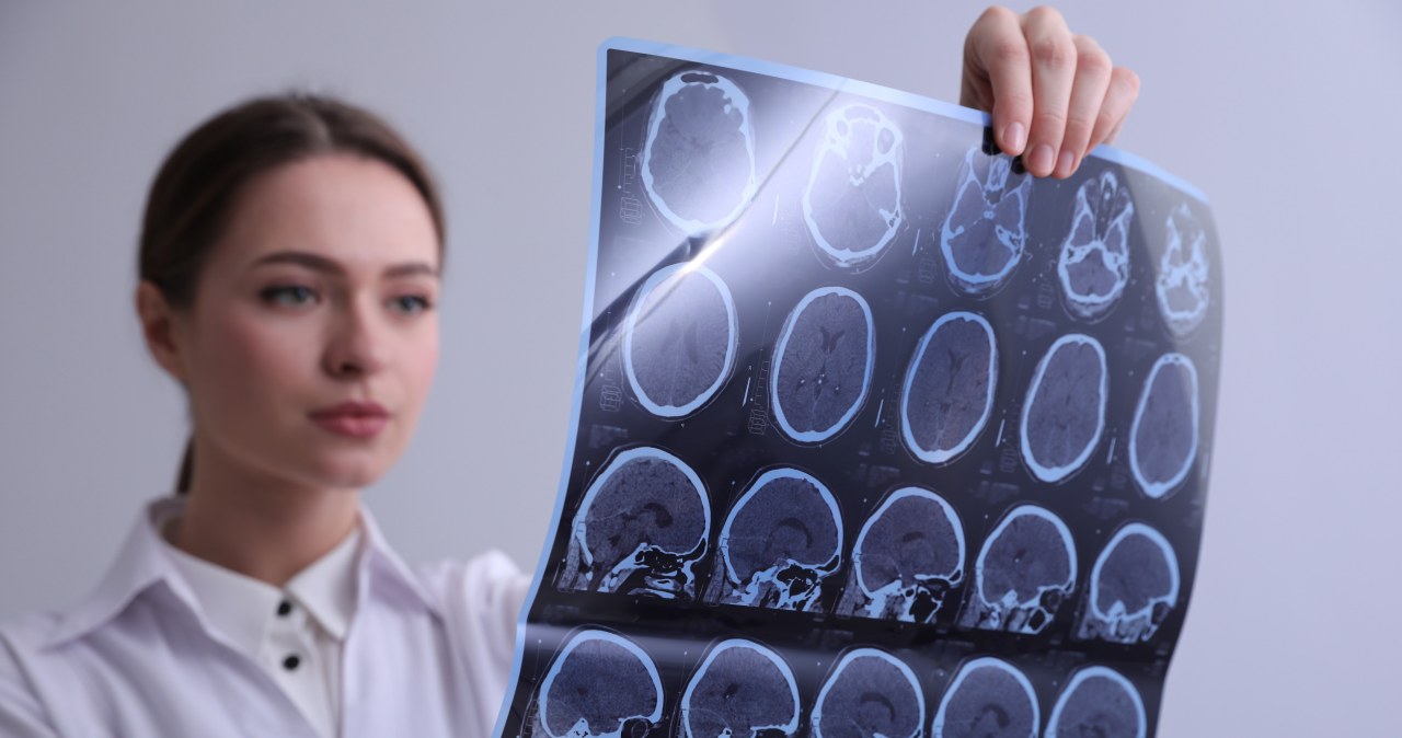 W kilka sekund diagnozuje choroby mózgu. "Jak ChatGPT dla medycyny"